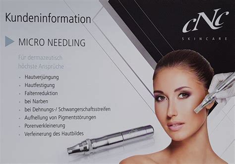 Micro Needling Nadin Augustfehn
