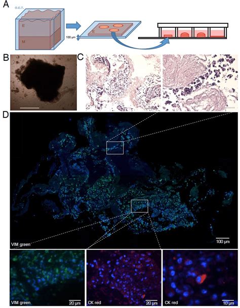 Recellularization Process In Uterine Decellularized Disks From Whole