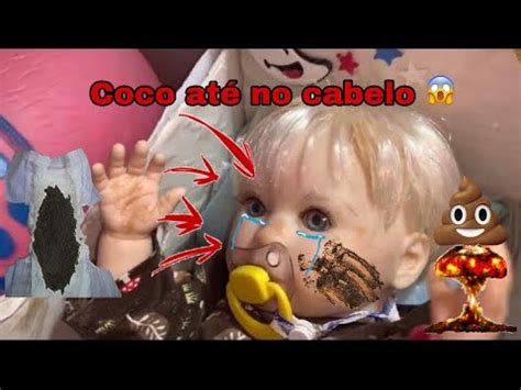 A Maior Explos O De Coco Do Baby Abandonado Filipe Sujou Todo O Rosto