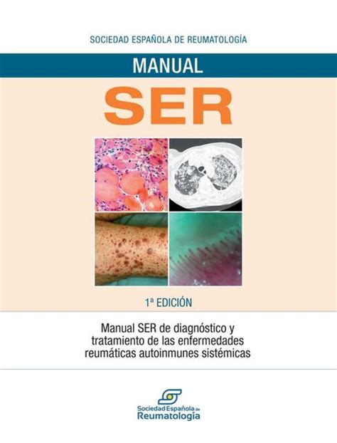 Manual SER de Diagnóstico y Tratamiento de las Enfermedades Reumáticas