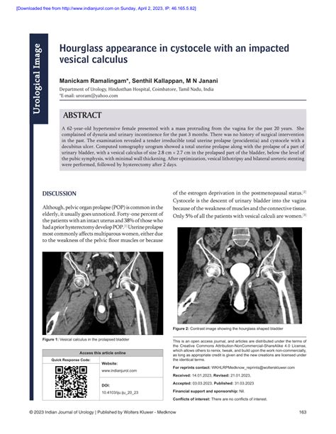 PDF Hourglass Appearance In Cystocele With An Impacted Vesical Calculus