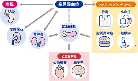 放置しているとどうなるの？｜なるほど尿酸com