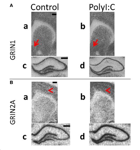 Representative In Situ Hybridization Films Of N Methyl D Aspartate