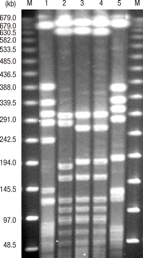 Pulsed Field Gel Electrophoresis Pfge Patterns Of Mrsa Isolates From