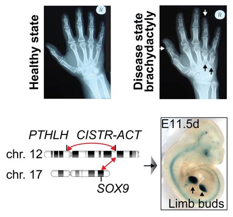 Research In Philipp Maass Lab