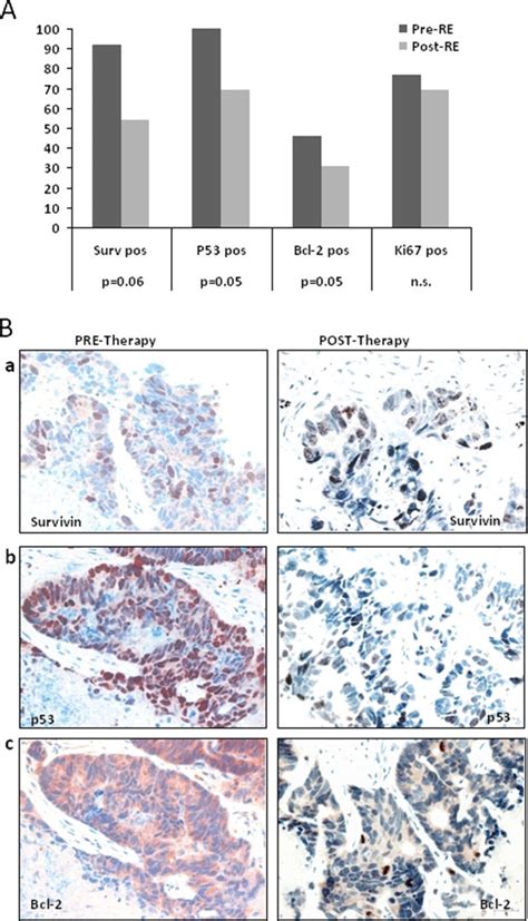 Changes Of Survivin P Bcl And Ki In Liver Metastases Pre And