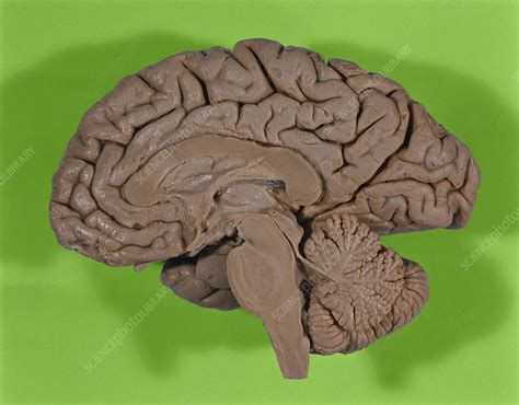 Half Of A Brain Stock Image C0271023 Science Photo Library