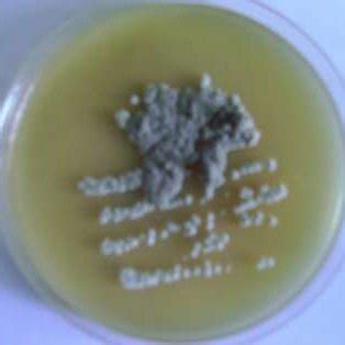 Colonies Of Streptomyces Gelaticus Sam On Yeast Malt Extract Agar