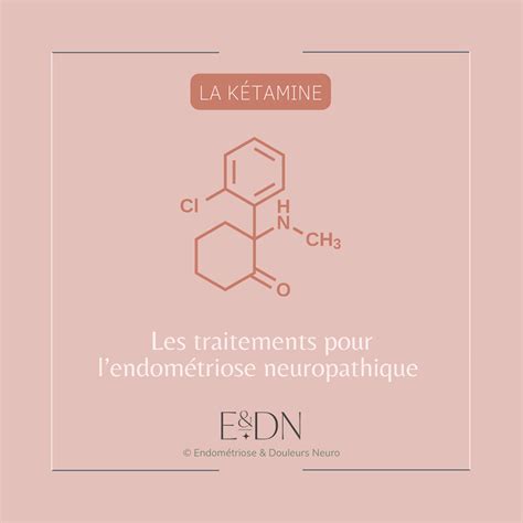 Les traitements pour lendométriose neuropathique La kétamine