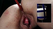 Enema Punishment Search XVIDEOS