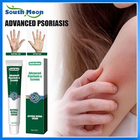 South Moon Psoriasis Cream Antibacterial Cream Anti Itch Relief Eczema Skin Rash Urticaria