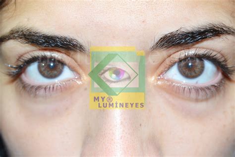 Clinical Photo Archive (Illustrative) | Lumineyes
