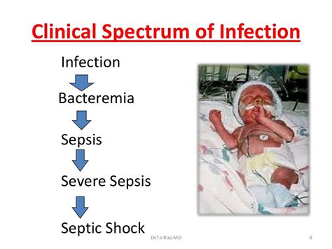 Septic Shock Pathophysiology