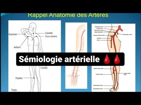 SÉMIOLOGIE VASCULAIRE Insuffisance artérielle aiguë et chronique