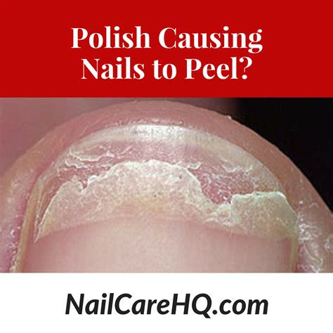 Ask Doug Peeling Nails With Polish