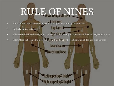 Rule Of Nines Explained