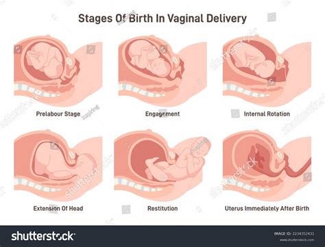 Stages Baby Birth Vaginal Delivery Fetus Stock Vector (Royalty Free ...