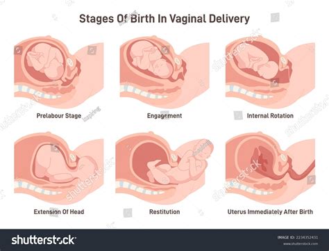 Vaginal Delivery Steps