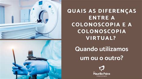 Colonoscopia e colonoscopia virtual você sabe a diferença YouTube