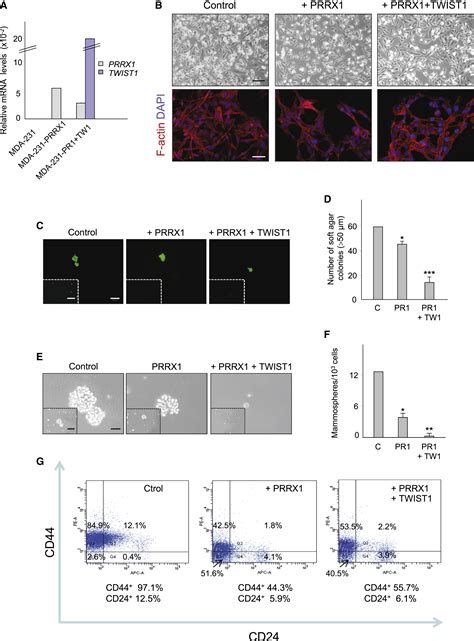 Metastatic Colonization Requires The Repression Of The Epithelial Mesenchymal Transition Inducer