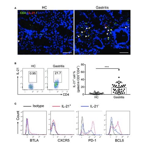 Identification Of Il Tfh Like Cells In Helicobacter