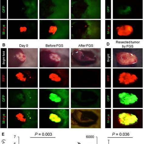 Comparison Of OBP 401 Based Fluorescence Guided Surgery With Bright