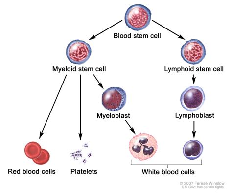 Risk Factors And Precautions For Acute Myeloid Leukemia Ask The Nurse