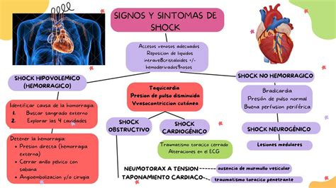 Signos Y Síntomas De Shock Hipovolémico Erica Af Udocz