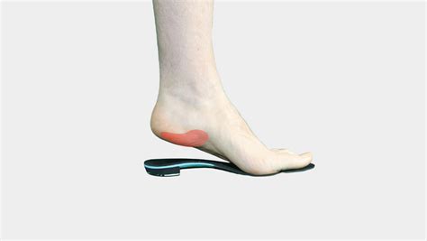 Plantar Fasciitis Insoles Best Insoles For Plantar Fasciitis Custom