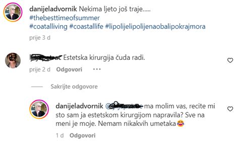 Estetska Kirurgija Uda Radi Danijelu Dvornik Naljutio Komentar