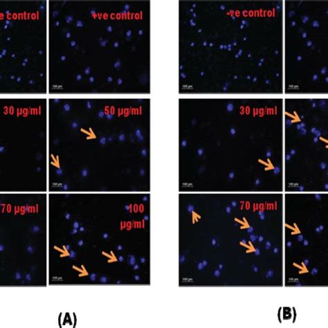 Apoptosis Inducing Activity Of Lc Pis In A549 Cells A Lc Pi I