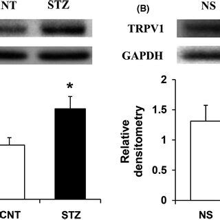 Stz Injection Upregulated The Expression Of Trpv In Drg Whereas Ala