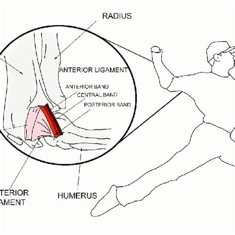 Anatomical sketch of the UCL during pitching. The UCL consists of the... | Download Scientific ...