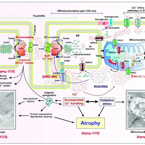 Schematic model showing proposed molecular mechanisms for altered Ca 2 ... 