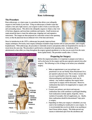 Fillable Online Knee Arthroscopy Or A Knee Scope Is A Procedure That