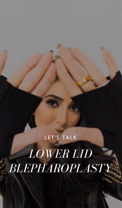 Lower Eyelid Blepharoplasty The Naz Experience Dr Maryam