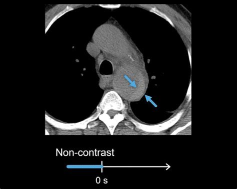 Abdominal Ct Phases Litfl Radiology Library