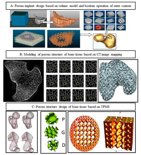 Applied Sciences Free Full Text Design And 3d Printing Of Interbody