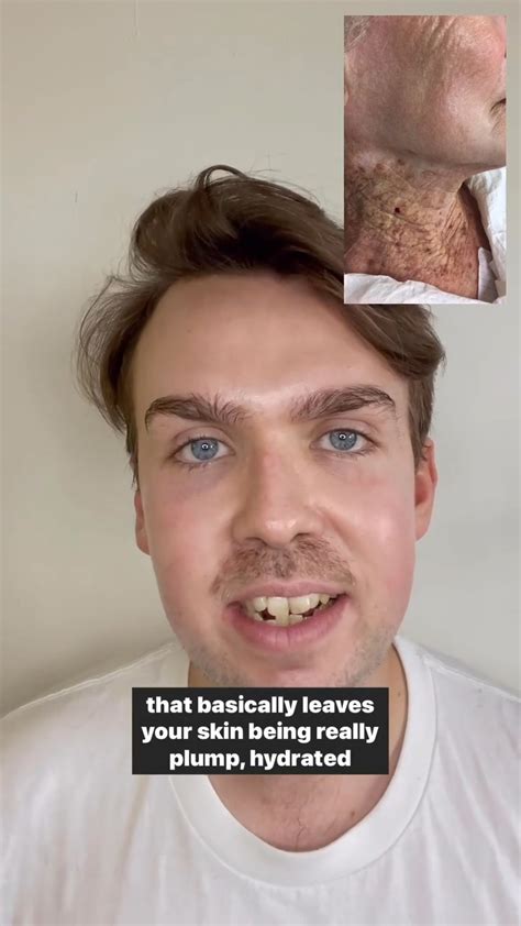 No neck sunscreen for 40 years ☀️ | This image of a woman who used an ...