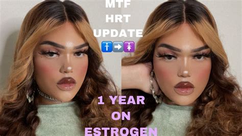 1 YEAR ON ESTROGEN TRANSGENDER MTF HRT UPDATE Mileena Camille