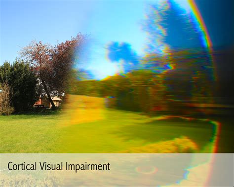 Cortical Visual Impairment 4sight Vision Support
