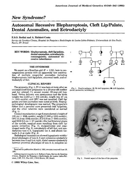 Pdf Autosomal Recessive Blepharoptosis Cleft Lip Palate Dental