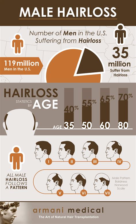 Infographic Male Hair Loss Patterns Armani Medical