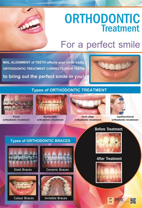 Types of Orthodontic treatment + Different types of braces (Eng.) DP-14 ...