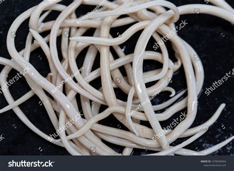 Ascariasis is a disease caused by the parasitic roundworm Ascaris ...