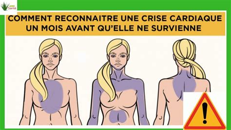 Comment Reconnaitre Une Crise Cardiaque Un Mois Avant Quelle Ne Survienne Youtube