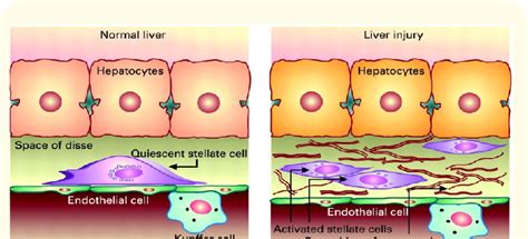 Diagram Illustrates The 4 Major Liver Cell Types Hepatocytes Kupffer