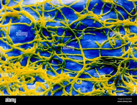 Legionella Bacteria Coloured Scanning Electron Micrograph Sem Of