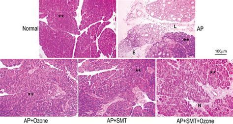 Representative Images Showing The Histological Changes In Pancreatic