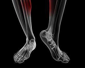 Advice On Stretching Your Calf Muscles Linkfield Physiotherapy